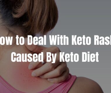 How to Deal with Keto Rash Caused by Keto Diet