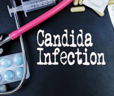 High-Carb Diets Can Cause Candida Infection