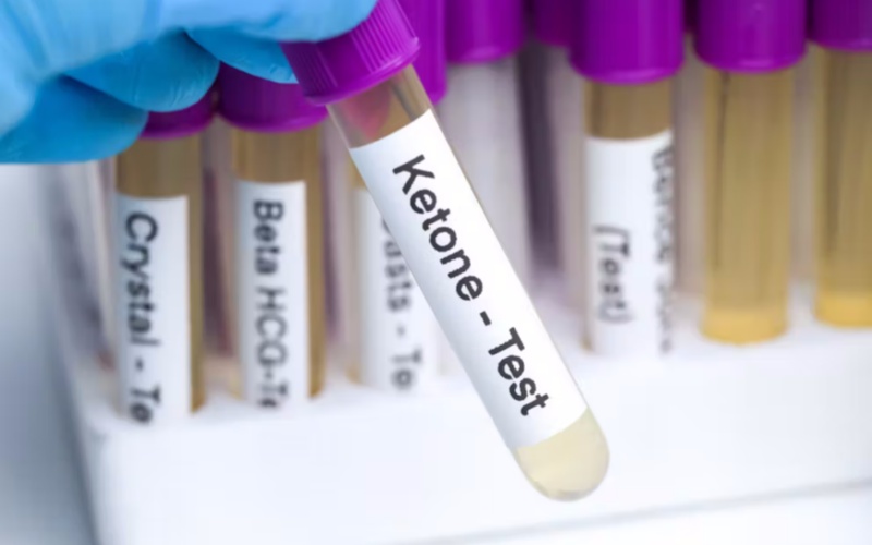 Ketone Levels Measured