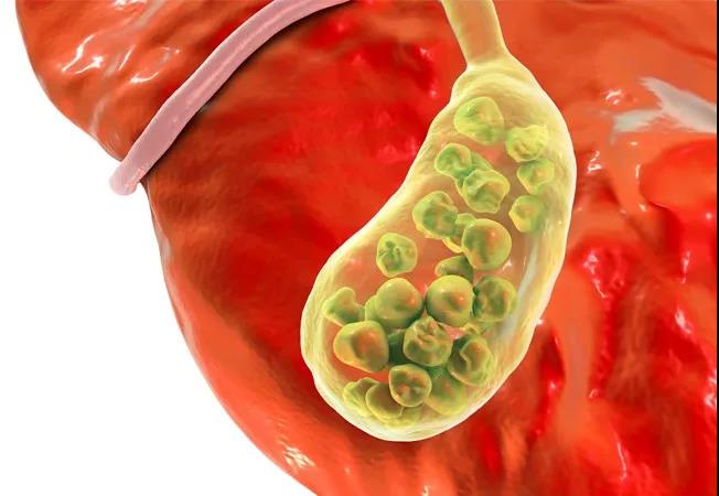 What does the gallbladder store bile for