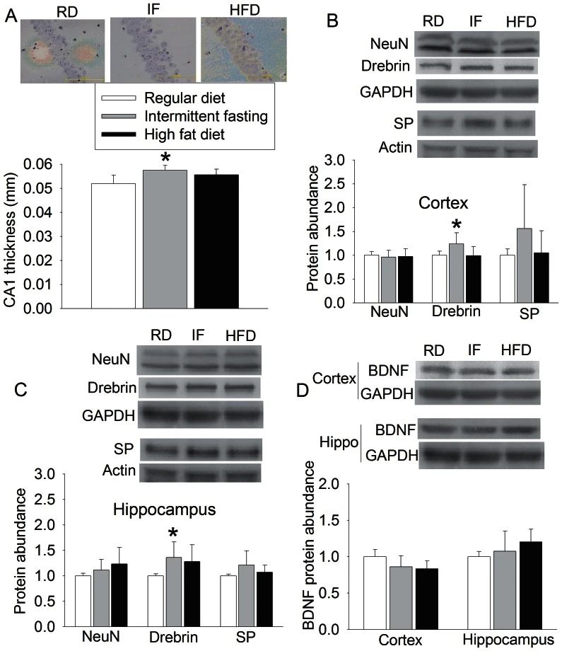 Measurements of NeuN, drebrin, and synaptophysin expression